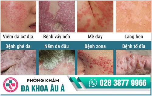 Phòng khám da liễu