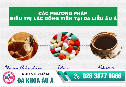 Chữa lác đồng tiền như thế nào hiệu quả, an toàn