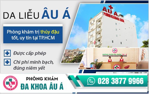 bệnh thủy đậu