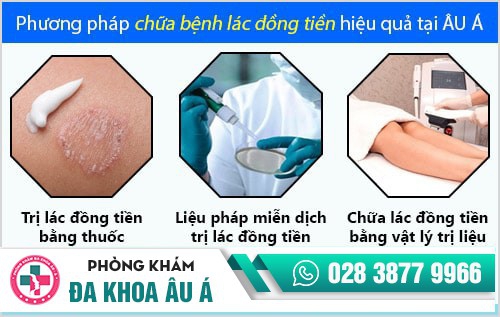 Lác đồng tiền