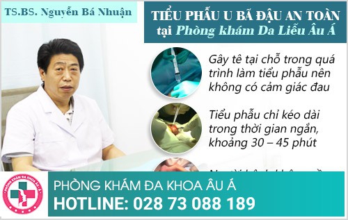 tiểu phẫu u bã đậu